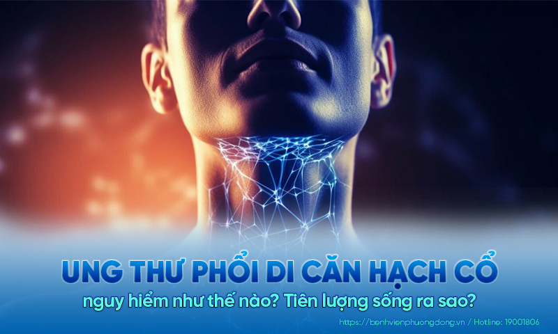 Ung thư phổi di căn hạch ở cổ nguy hiểm như thế nào? Tiên lượng sống ra sao?