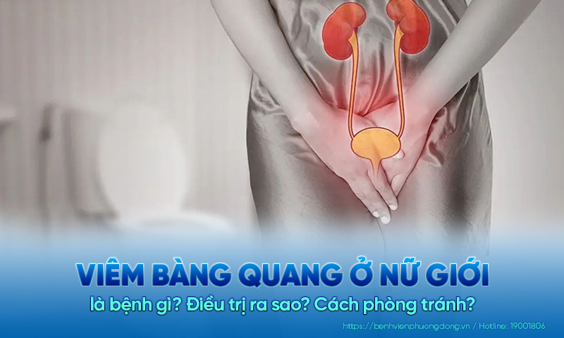 Viêm bàng quang ở nữ giới là bệnh gì? Điều trị ra sao? Cách phòng tránh?