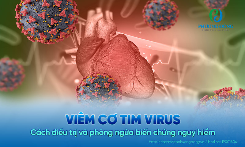 Viêm cơ tim virus: Cách điều trị và phòng ngừa biến chứng nguy hiểm