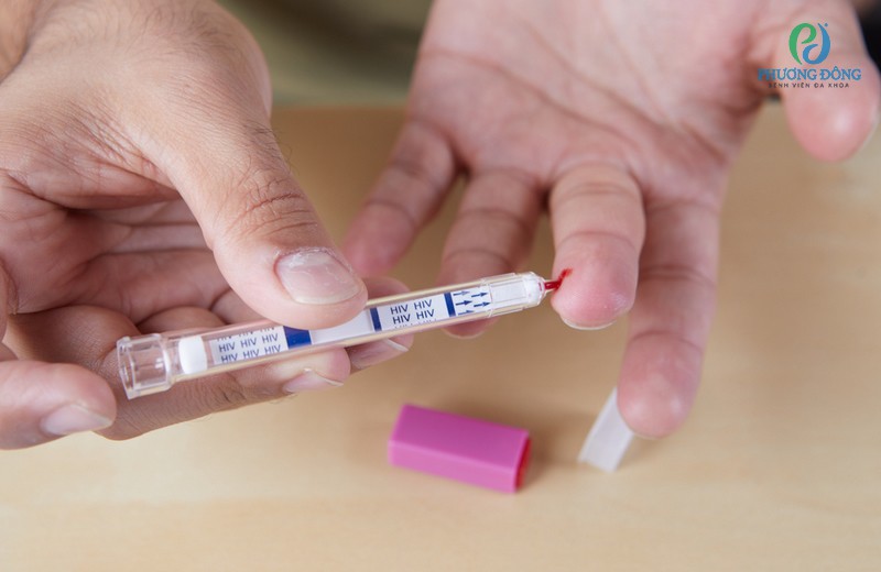 Xét nghiệm HIV có được ăn sáng không? Cần lưu ý gì?