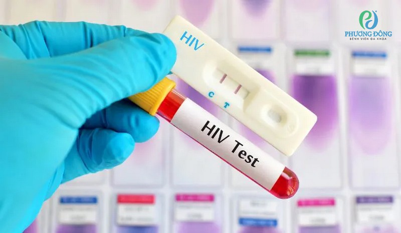 Xét nghiệm HIV sau 1 tuần có chính xác không? Độ chính xác là bao nhiêu?