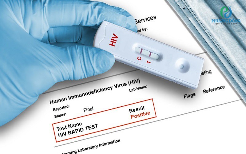 Hỏi đáp: Xét nghiệm HIV sau 3 tuần có chính xác không?