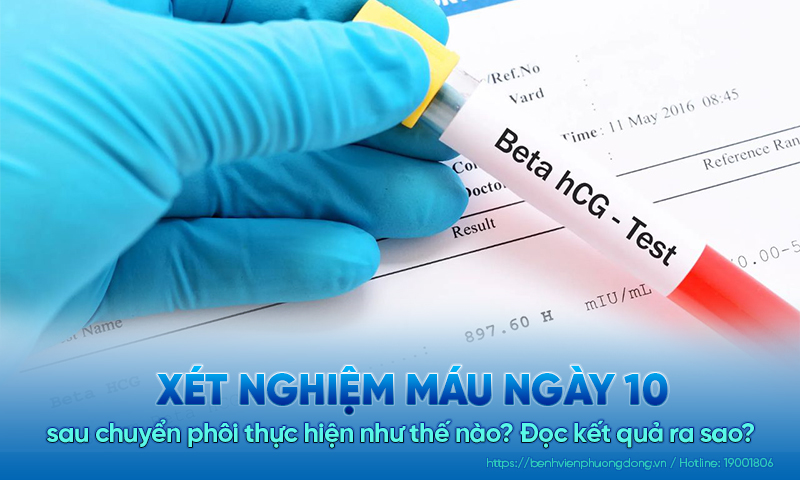 Xét nghiệm máu ngày 10 sau chuyển phôi thực hiện như thế nào?