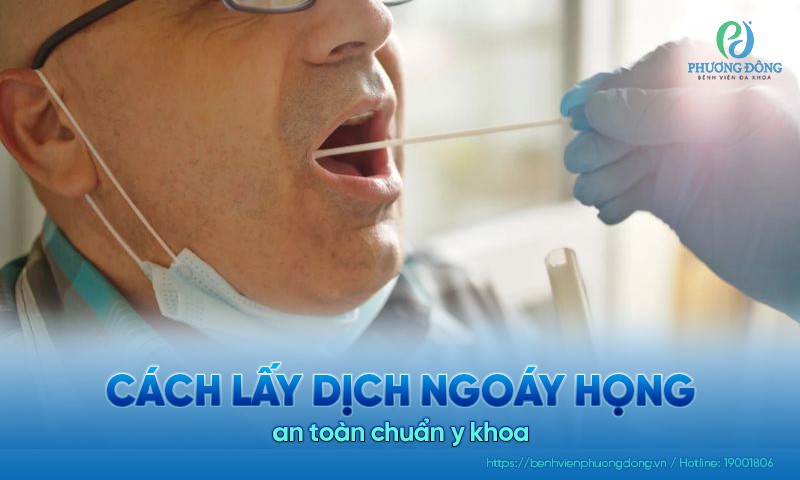 Cách lấy dịch ngoáy họng an toàn chuẩn y khoa