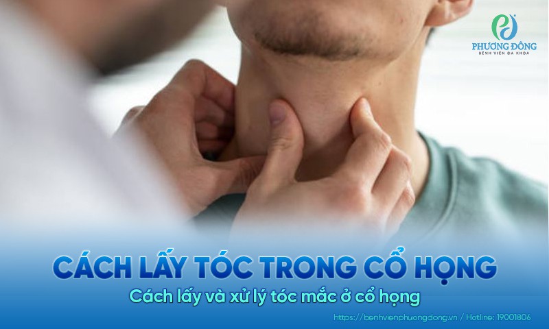 Cách lấy tóc trong cổ họng: Cách lấy và xử lý tóc mắc ở cổ họng