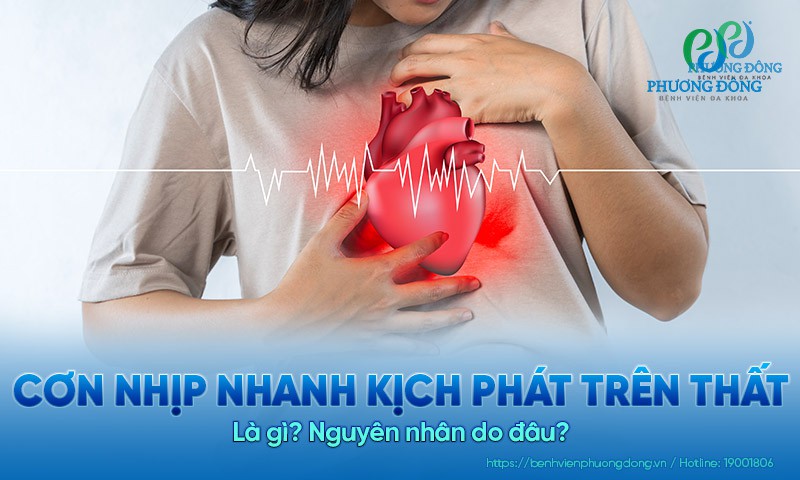 Cơn nhịp nhanh kịch phát trên thất là gì? Nguyên nhân do đâu? 