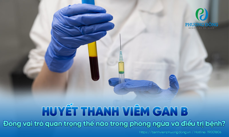 Huyết thanh viêm gan B đóng vai trò gì trong phòng ngừa và điều trị bệnh?