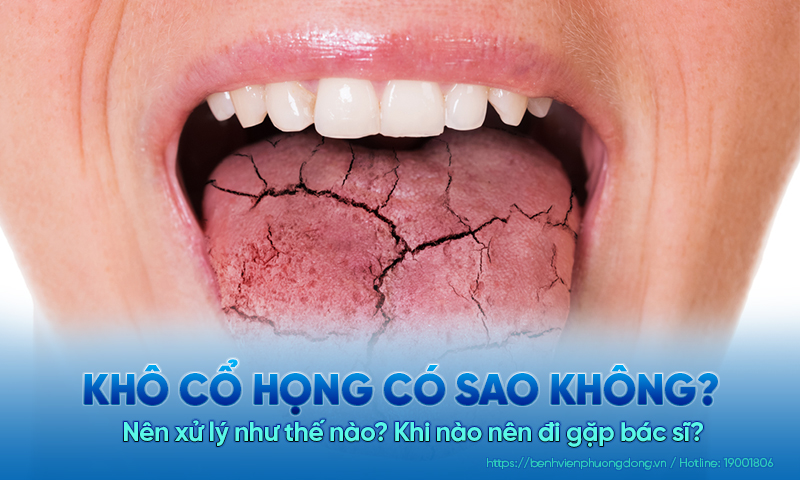 Khô cổ họng có sao không? Nên xử lý như thế nào? Khi nào nên đi gặp bác sĩ?