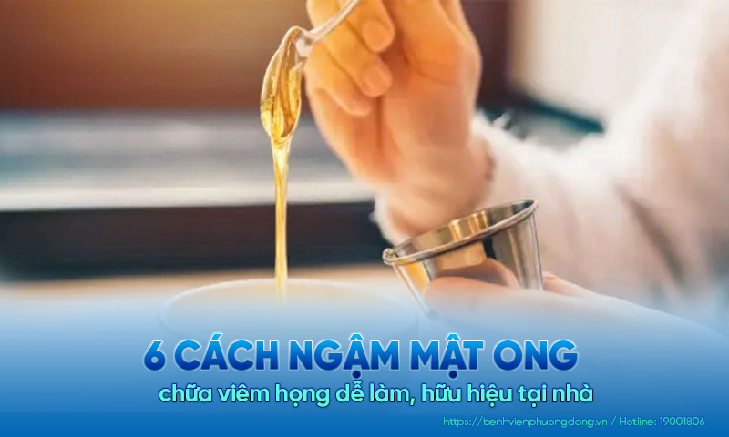 6 Cách ngậm mật ong chữa viêm họng dễ làm, hữu hiệu tại nhà