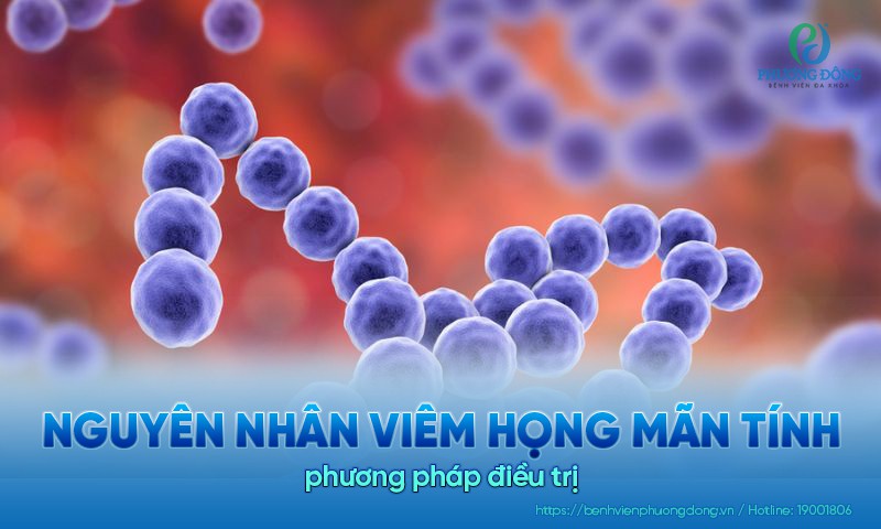Nguyên nhân viêm họng mãn tính và phương pháp điều trị