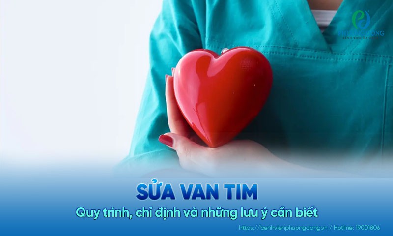 Sửa van tim: Quy trình, chỉ định và những lưu ý cần biết