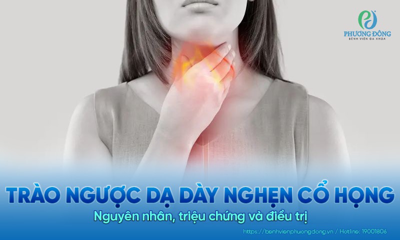 Trào ngược dạ dày nghẹn cổ họng: Nguyên nhân, triệu chứng và điều trị