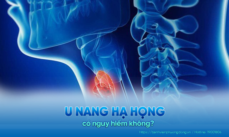 Giải đáp chi tiết: U nang hạ họng có nguy hiểm không?