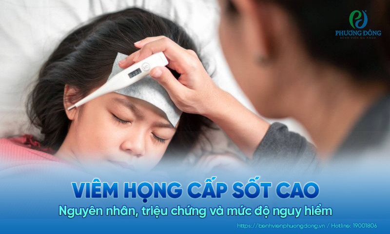 Viêm họng cấp sốt cao​: Nguyên nhân, triệu chứng và mức độ nguy hiểm