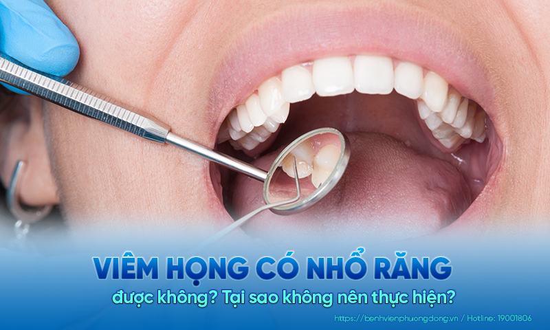Viêm họng có nhổ răng được không? Tại sao không nên?