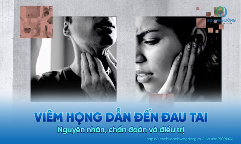 Viêm họng dẫn đến đau tai: Nguyên nhân, chẩn đoán và điều trị