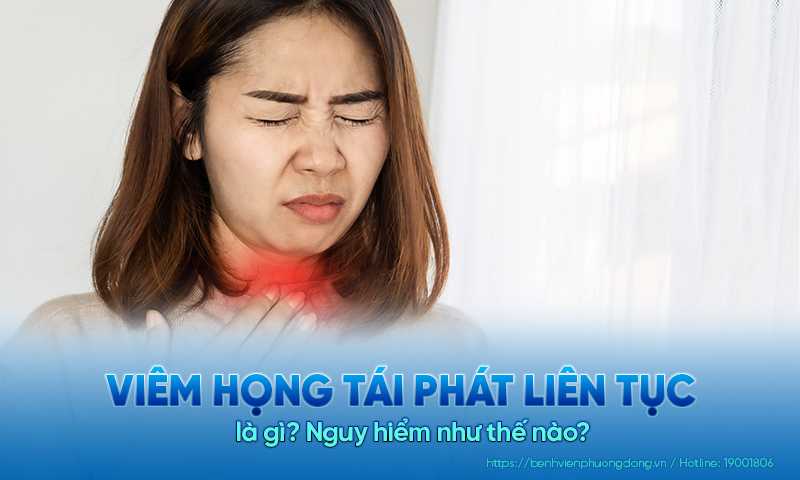 Viêm họng tái phát liên tục là gì? Nguy hiểm như thế nào?