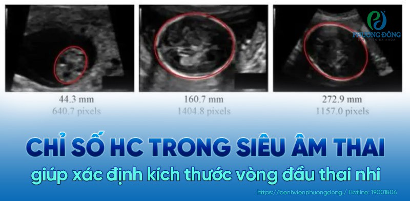 (Hình 3 - Chu vi vòng đầu thai nhi khác nhau trong siêu âm của 3 thai phụ)