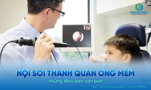 Nội soi thanh quản ống mềm và những điều bạn cần biết