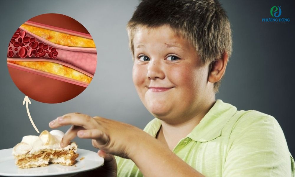 Chế độ ăn uống lành mạnh làm giảm rối loạn mỡ máu ở trẻ em