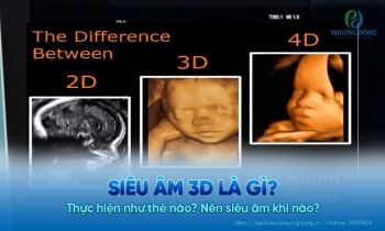 Siêu âm 3D: Lợi ích và nguy cơ khi mẹ bầu cần lưu ý khi thực hiện