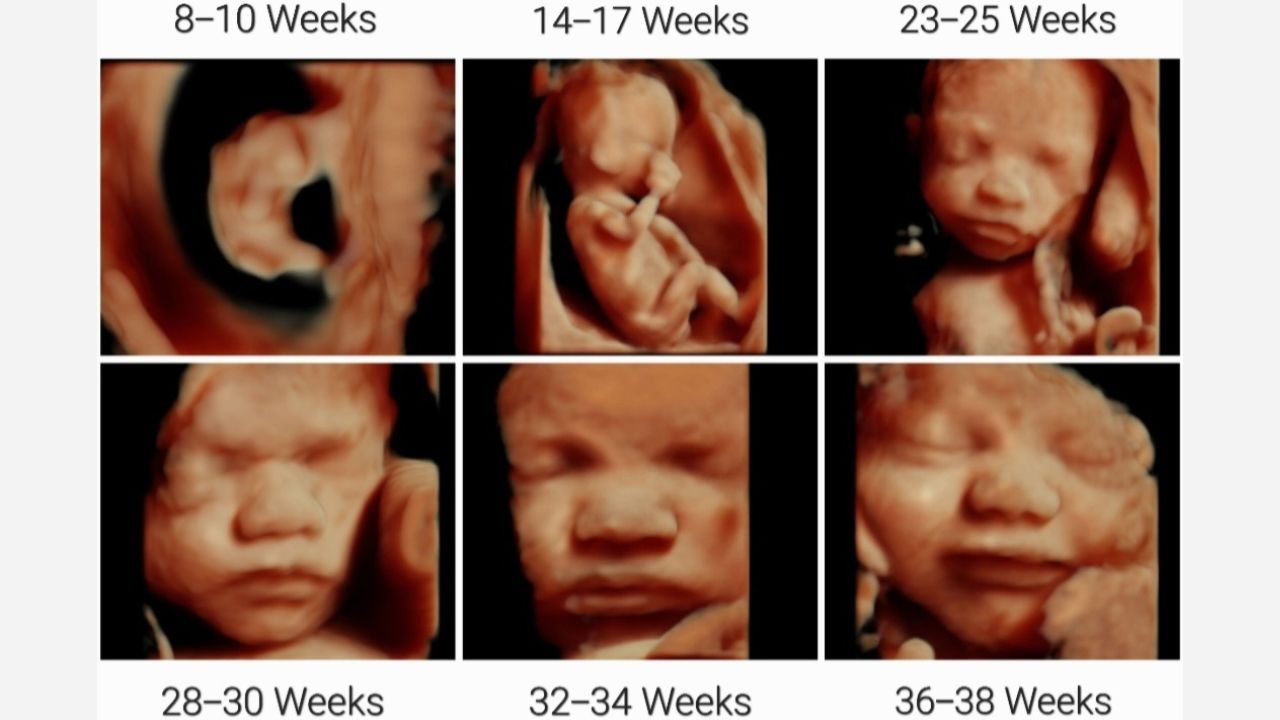 (Hình 2 - Theo dõi sự phát triển của em bé qua các mốc siêu âm quan trọng trong thai kỳ)