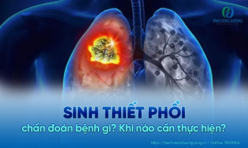 Giải mã bí ẩn phổi: Sinh thiết phổi là gì và khi nào cần thực hiện?