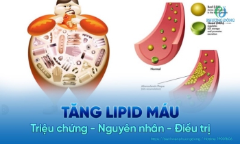 Tăng lipid máu: Triệu chứng - Nguyên nhân - Phương pháp điều trị