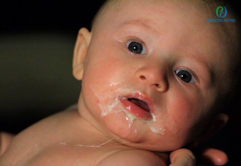 Tần suất nôn mửa nhiều hoặc trẻ không bú sữa mẹ thì nên đến bệnh viện
