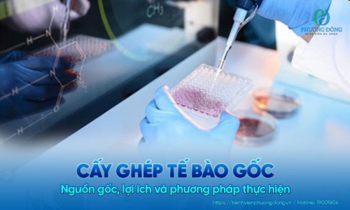 Cấy ghép tế bào gốc là gì? Nguồn gốc, lợi ích và phương pháp thực hiện