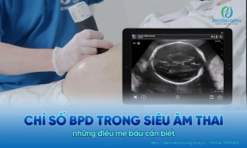 Chỉ số BPD trong siêu âm thai là gì? Hướng dẫn theo dõi cho mẹ bầu