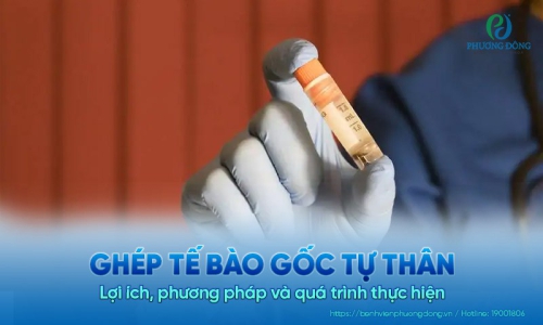 Cấy ghép tế bào gốc tự thân: Lợi ích, phương pháp và quá trình thực hiện