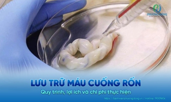 Lưu trữ máu cuống rốn là gì? Quy trình, lợi ích và chi phí thực hiện