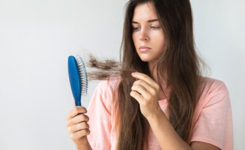 Bí quyết khắc phục tình trạng rụng tóc sau sốt xuất huyết đơn giản và hiệu quả