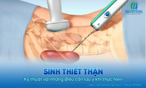 Kỹ thuật sinh thiết thận và những điều cần lưu ý khi thực hiện