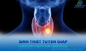 Sinh thiết tuyến giáp: Chẩn đoán chính xác về các bệnh lý của tuyến giáp