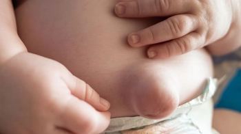 Thoát vị rốn ở trẻ sơ sinh: Dấu hiệu nhận biết và cách điều trị