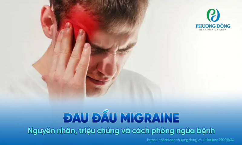 Đau đầu migraine: Nguyên nhân, triệu chứng và cách phòng ngừa bệnh