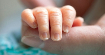Đầu ngón tay thâm đen ở trẻ sơ sinh thì sao? Khi nào phải đi khám?