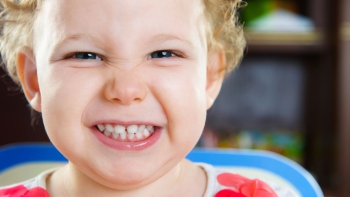 Hai răng cửa của bé bị hở thì sao? Có nên cho con niềng răng không?