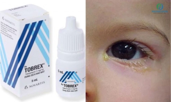 Thuốc nhỏ mắt Tobrex cho trẻ em: Liều lượng và cách sử dụng