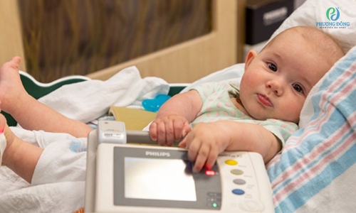 Bệnh tim bẩm sinh trẻ em: Dấu hiệu nhận biết và cách phát hiện sớm