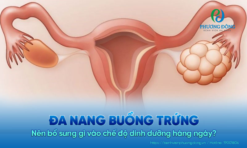 Đa nang buồng trứng nên ăn gì để có thai tự nhiên?