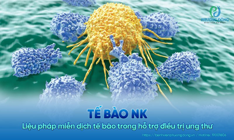 Tế bào NK: Liệu pháp miễn dịch tế bào trong hỗ trợ điều trị ung thư