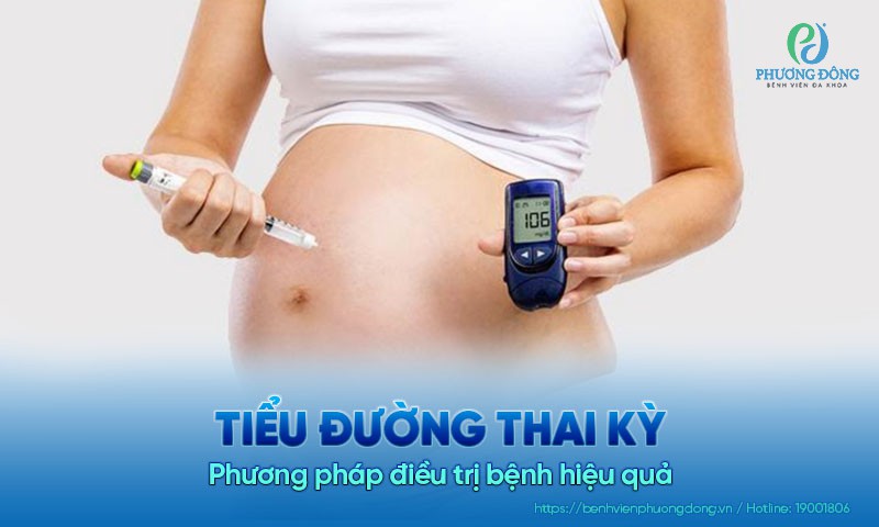 Phương pháp điều trị tiểu đường thai kỳ hiệu quả