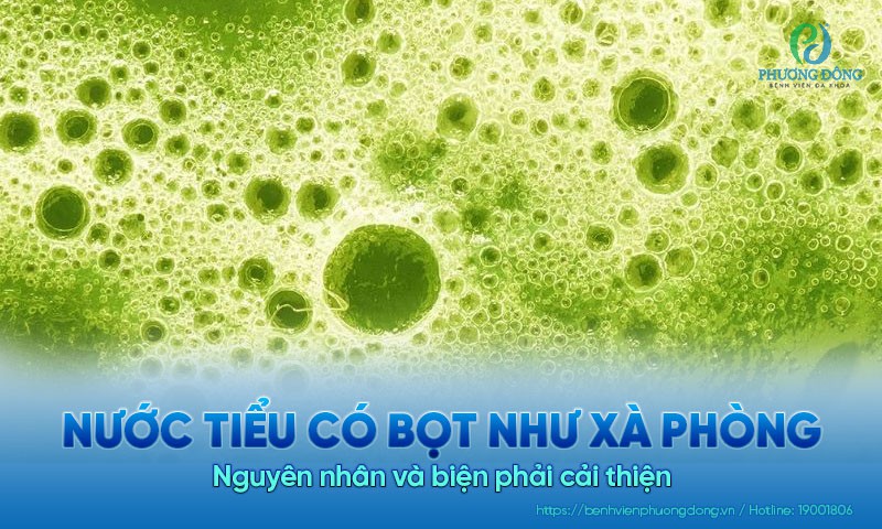 Nước tiểu có bọt như xà phòng là triệu chứng của bệnh gì?