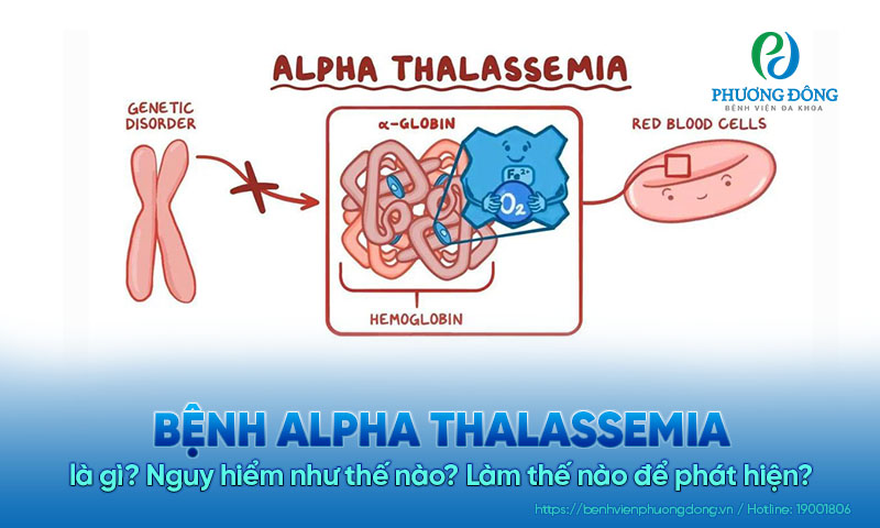 Bệnh alpha thalassemia là gì? Nguy hiểm như thế nào? Làm thế nào để phát hiện?