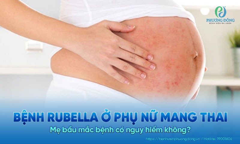 Bệnh Rubella ở phụ nữ mang thai nguy hiểm như thế nào?