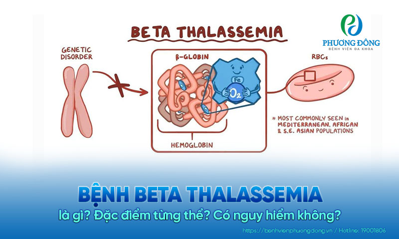 Bệnh beta thalassemia là gì? Đặc điểm từng thể? Có nguy hiểm không?