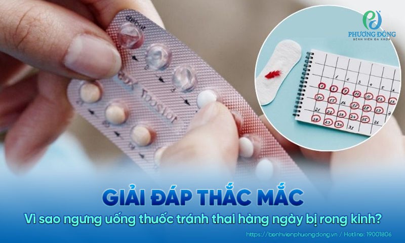 Ngừng Uống Thuốc Tránh Thai Hàng Ngày Bị Rong Kinh: Nguyên Nhân, Biện Pháp Xử Lý Và Phòng Ngừa